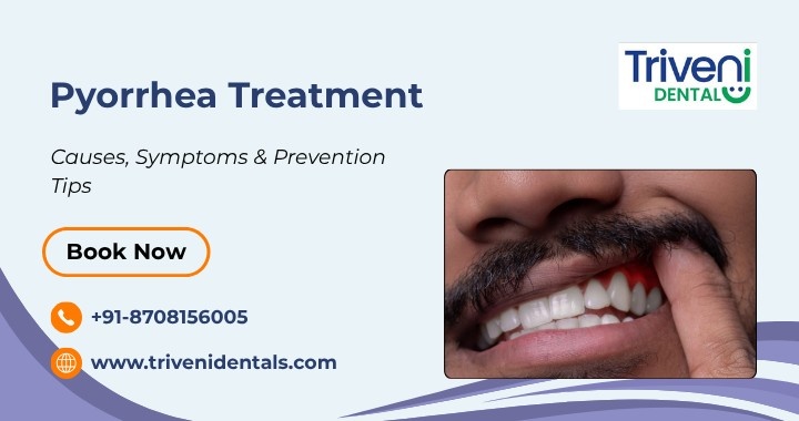 What is Pyorrhea? Causes, Symptoms, Treatment & Prevention
