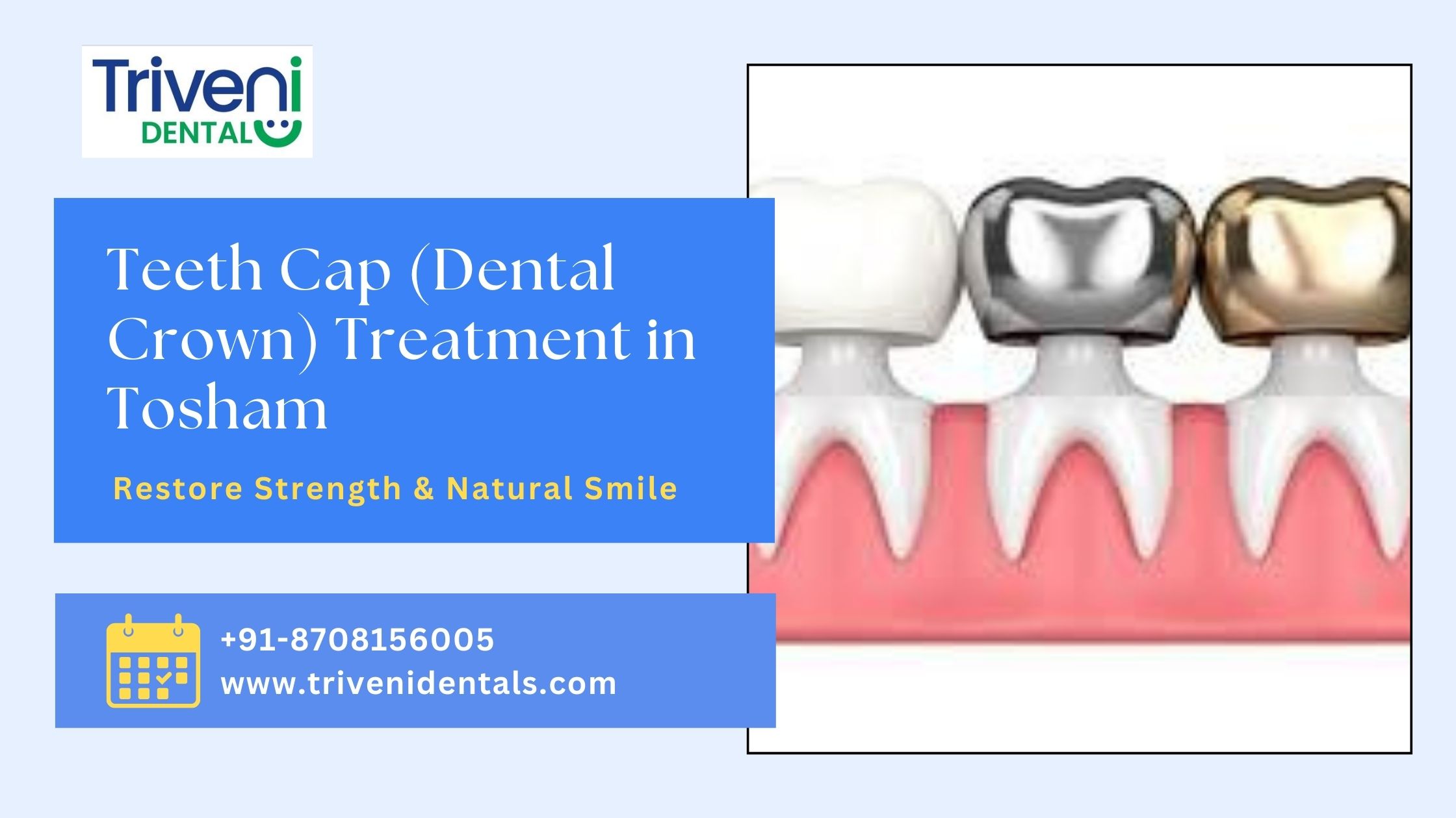 Teeth Cap (Dental Crown) Treatment in Tosham – Complete Guide