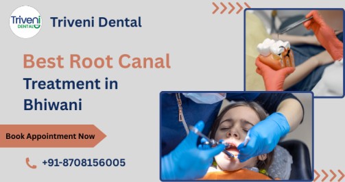 Best Root Canal Treatment in Bhiwani: Cost, Procedure & Benefits
