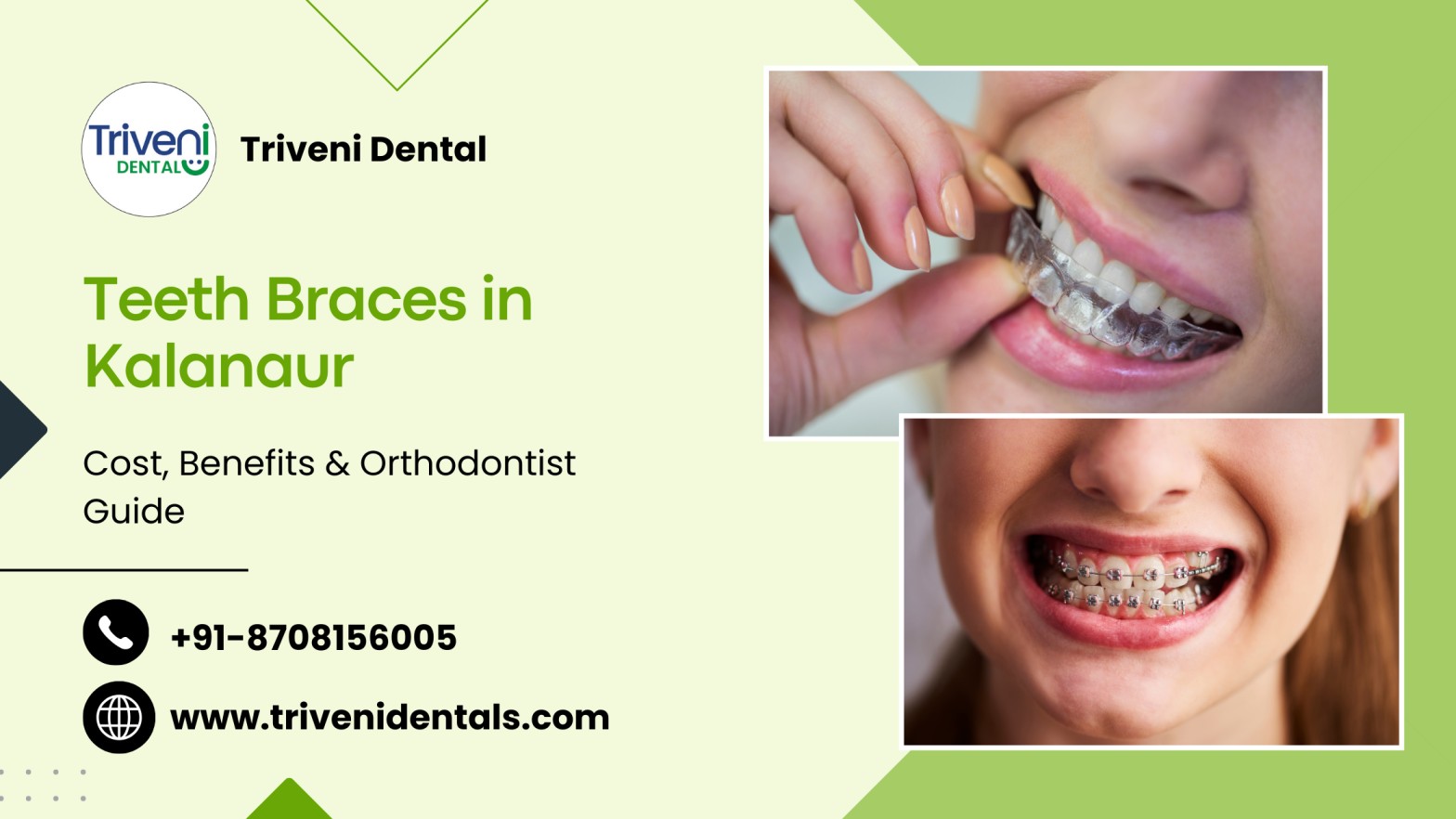 Teeth Braces in Kalanaur: Cost, Benefits & Orthodontist Guide