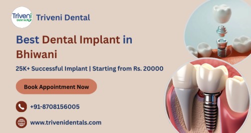 Thinking About Dental Implants in Bhiwani? Here’s What to Expect
